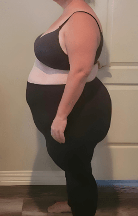 Before transformation