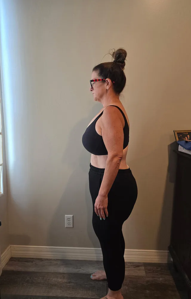 Holly after making progress in her medical weight loss journey